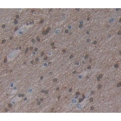 Myelin Transcription Factor 1 (MYT1) Antibody