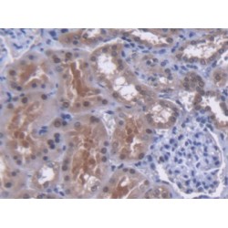 MutY Homolog (MUTYH) Antibody