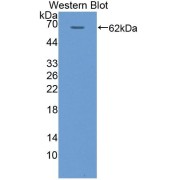 Western blot analysis of the recombinant protein.