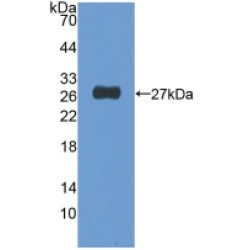 Nucleoporin 155 kDa (NUP155) Antibody