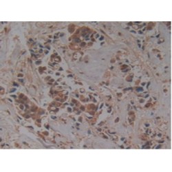 Nucleoporin 155 kDa (NUP155) Antibody