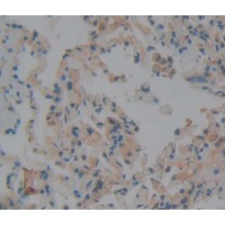 Neuroblastoma, Suppression of Tumorigenicity 1 (NBL1) Antibody