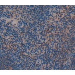 Neutrophil Cytosolic Factor 1 (NCF1) Antibody