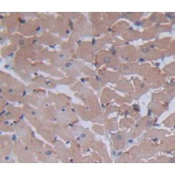 BCL2/Adenovirus E1B 19 kDa Protein-Interacting Protein 3 (BNIP3) Antibody