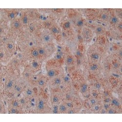 Sterol Carrier Protein 2 (SCP2) Antibody