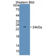 Western blot analysis of recombinant Human OLFM3.