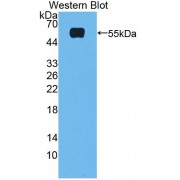 Western blot analysis of recombinant Rat FXR.