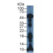 Western blot analysis of Rat Heart lysate, using Mouse NT-ProANP Antibody (1 µg/ml) and HRP-conjugated Goat Anti-Rabbit antibody (<a href="https://www.abbexa.com/index.php?route=product/search&amp;search=abx400043" target="_blank">abx400043</a>, 0.2 µg/ml).