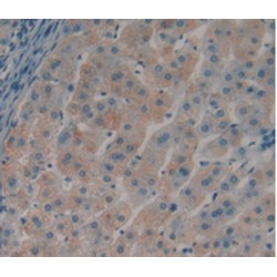 Cross Linked N-Telopeptide of Type I Collagen (NTXI) Antibody