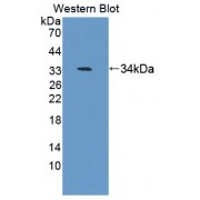Western blot analysis of recombinant Rat AZIN1.