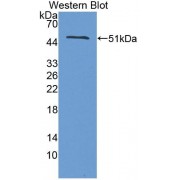Western blot analysis of the recombinant Mouse TRIP6 protein.