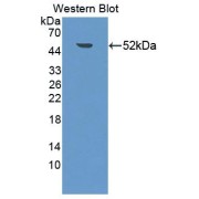 Western blot analysis of the recombinant protein.