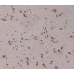 Neuro Oncological Ventral Antigen 1 (NOVA1) Antibody