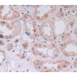 Uridine Monophosphate Synthetase (UMPS) Antibody