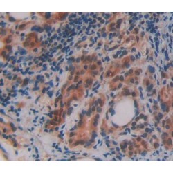 Oxysterol Binding Protein (OSBP) Antibody