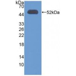 3-Oxoacid Coenzyme A Transferase 1 (OXCT1) Antibody