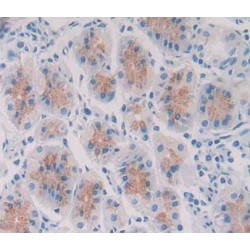 Phosphoinositide-3-Kinase Catalytic Delta Polypeptide (PIK3Cd) Antibody