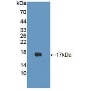 Western blot analysis of recombinant Mouse CDKN2B.
