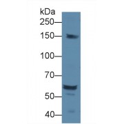 Western blot analysis of Rat Serum, using Rat DOK1 Antibody (1 µg/ml) and HRP-conjugated Goat Anti-Rabbit antibody (<a href="https://www.abbexa.com/index.php?route=product/search&amp;search=abx400043" target="_blank">abx400043</a>, 0.2 µg/ml).