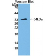 Western blot analysis of recombinant Human PAM.