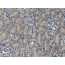 Glutamyl Prolyl tRNA Synthetase (EPRS) Antibody