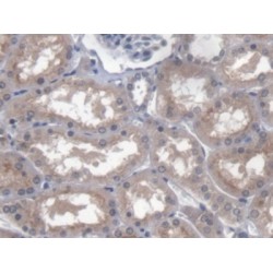 Pituitary Tumor Transforming 1 Interacting Protein (PTTG1IP) Antibody