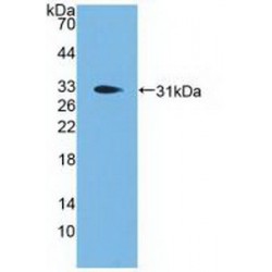 Neuroendocrine Convertase 1 (PCSK1) Antibody