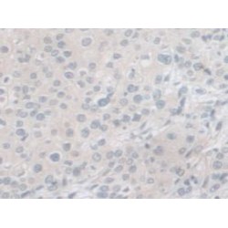 Neuroendocrine Convertase 1 (PCSK1) Antibody