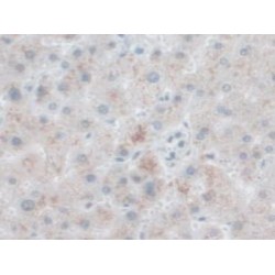 Neuroendocrine Convertase 1 (PCSK1) Antibody