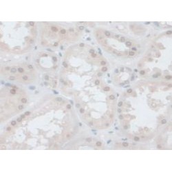 Neuroendocrine Convertase 1 (PCSK1) Antibody