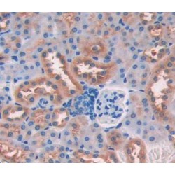 Cyclin Dependent Kinase 18 (CDK18) Antibody