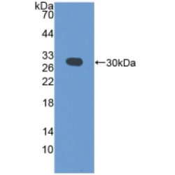 Programmed Cell Death 6-Interacting Protein (PDCD6IP) Antibody