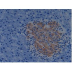 Programmed Cell Death 6-Interacting Protein (PDCD6IP) Antibody