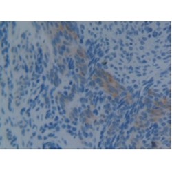 Programmed Cell Death 6-Interacting Protein (PDCD6IP) Antibody