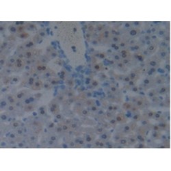 Programmed Cell Death 6-Interacting Protein (PDCD6IP) Antibody