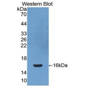 Western blot analysis of the recombinant protein.