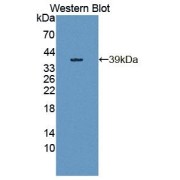 Western blot analysis of the recombinant protein.