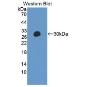 Western blot analysis of recombinant Rat PTPN14.