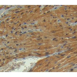 Phosphoglycerate Mutase 2, Muscle (PGAM2) Antibody
