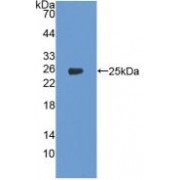 Western blot analysis of recombinant Human PTGS2.