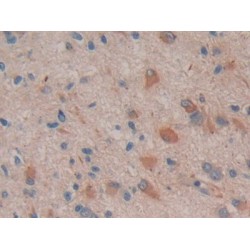 Prostaglandin G/H Synthase 2 / COX-2 (PTGS2) Antibody