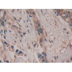 Prostaglandin G/H Synthase 2 / COX-2 (PTGS2) Antibody