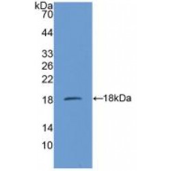 Succinate Dehydrogenase Complex Subunit D (SDHD) Antibody