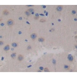 Succinate Dehydrogenase Complex Subunit C (SDHC) Antibody