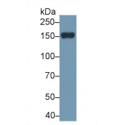 Western blot analysis of Rat Serum, using Rat PLCb2 Antibody (2 µg/ml) and HRP-conjugated Goat Anti-Rabbit antibody (<a href="https://www.abbexa.com/index.php?route=product/search&amp;search=abx400043" target="_blank">abx400043</a>, 0.2 µg/ml).