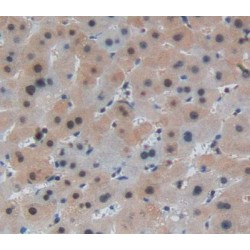 Leucine Rich Repeats And Death Domain Containing Protein (LRDD) Antibody