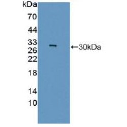 Guanidinoacetate-N-Methyltransferase (GAMT) Antibody