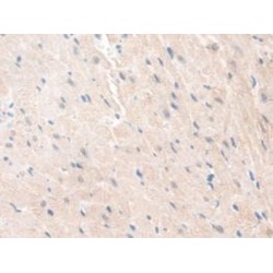 Guanidinoacetate-N-Methyltransferase (GAMT) Antibody