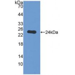 Guanidinoacetate-N-Methyltransferase (GAMT) Antibody