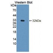 Western blot analysis of recombinant Human PLCb4 using Phospholipase C Beta 4 Antibody.